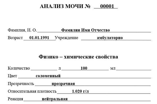 Анализы мочи